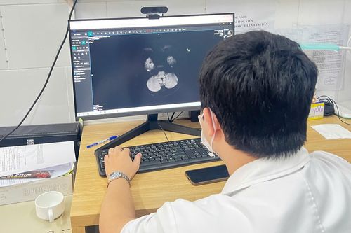 Tổn thương não, suy thận do hút thuốc lá điện tử chứa ma túy tổng hợp