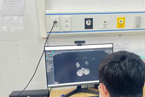 Tổn thương não vì ngộ độc thuốc lá điện tử chứa ma túy