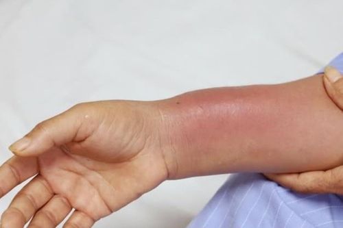 Gánh hậu quả nặng nề vì một sai lầm nhiều người làm khi đau