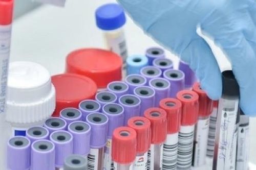 Chi phí xét nghiệm 30.000 tỷ đồng/năm, bất ngờ số tiền tiết kiệm khi liên thông