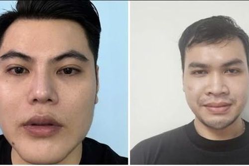 Nhóm đối tượng giả danh bác sĩ khám chữa bệnh lừa đảo, tuyển dụng cả nhân viên thú y chữa bệnh cho người