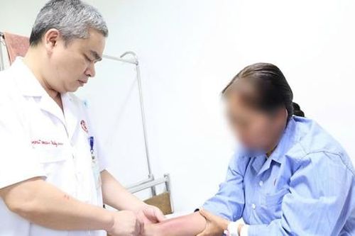 Cấy chỉ giảm đau xương khớp, người phụ nữ bị nhiễm trùng viêm mô bào