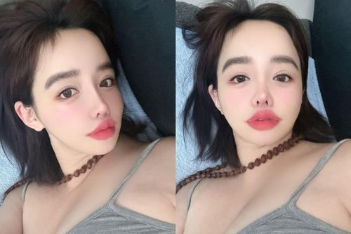 Park Bom giao tiếp khó khăn