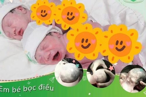 Ca sinh đôi đặc biệt, một bé chào đời còn nguyên trong bọc ối