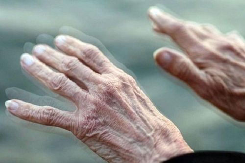 Lần đầu quan sát được 'mồi lửa' khởi phát bệnh Parkinson
