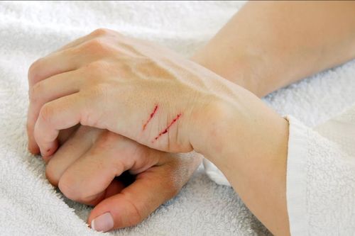 Israel phát triển keo dán vết thương trong 5 giây