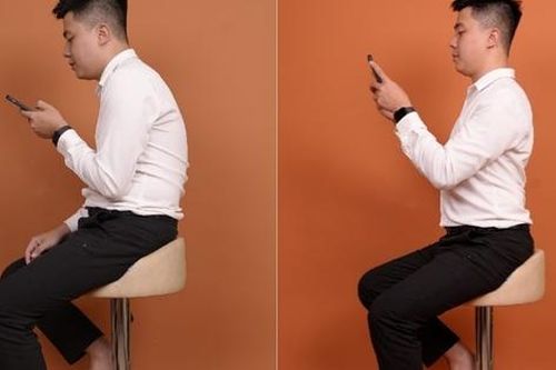 Cúi đầu lâu xem điện thoại, ngồi học sai tư thế cũng có thể ảnh hưởng đến sai khớp cắn