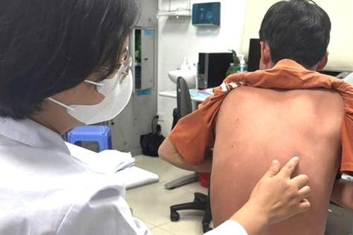 Tự chữa vảy nến, bệnh nhân không đi lại được, phải nằm cáng nhập viện