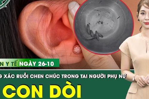 Bản Tin Y Tế 26/10: Xác ruồi cùng 5 con dòi chen chúc trong tai người phụ nữ