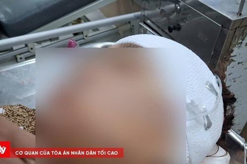 Làm rõ vụ dùng dao rọc giấy để đánh ghen