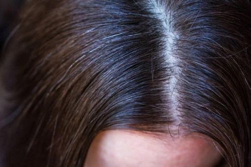 Việc nhổ tóc bạc có giúp tóc đen của bạn mọc lại không?