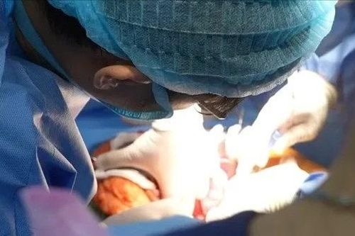 Ghép gan hồi sinh bệnh nhân từng 'chờ chết'