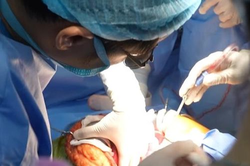 Ca ghép gan hồi sinh bệnh nhân từng 'chờ chết'