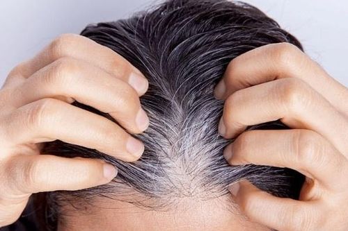 5 loại thực phẩm có thể giúp làm chậm hoặc ngăn ngừa tóc bạc sớm