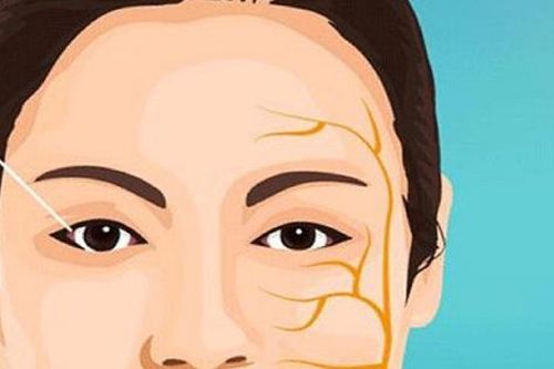 Phòng ngừa liệt dây thần kinh số VII