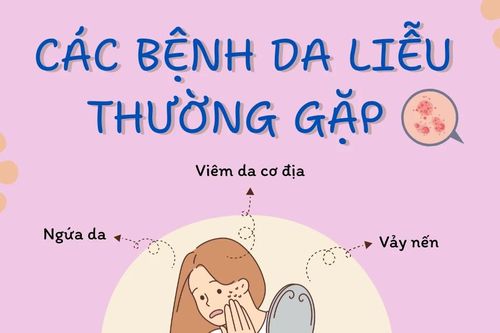 Tự mua thuốc điều trị da liễu dễ biến chứng kéo dài