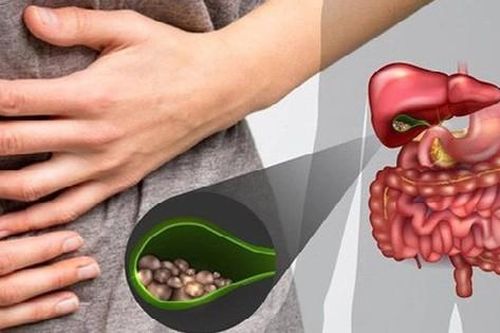 Đau bụng, sụt cân nhanh, người đàn ông phải cắt túi mật thừa nhận 1 sai lầm nhiều người Việt mắc phải
