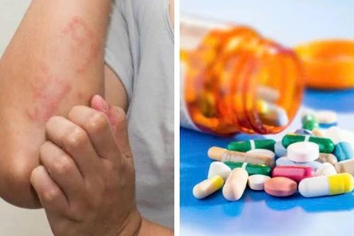Dị ứng kháng sinh, tai biến y khoa ai cũng có thể gặp