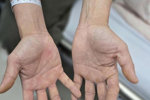 Đôi vợ chồng trẻ Hà Nội liệt người sau chơi 'bóng cười'