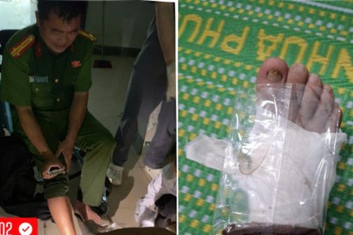 Trưởng công an xã bị thương vẫn bám hiện trường giúp dân sơ tán trong lũ