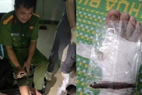 Trưởng Công an xã bị thanh gỗ đâm xuyên chân khi giúp người dân chạy lũ