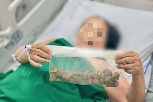 Người phụ nữ 78 tuổi nguy kịch do tự ý dùng loại củ này chữa đau khớp