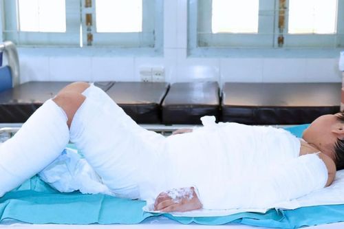 Bé trai 7 tuổi bỏng nặng sau tai nạn nồi nước sôi của xe bánh bao văng trúng