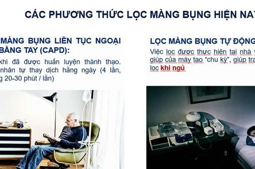 Thêm hướng điều trị cho bệnh nhân suy thận mạn giai đoạn cuối