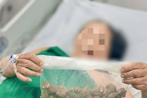 Sốc tim do sử dụng củ ấu tầu