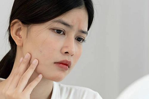 Các loại thực phẩm bổ sung quá mức gây hại cho làn da