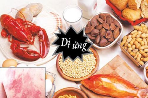 Bệnh Celiac nguy hiểm như thế nào?