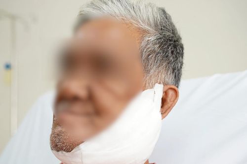 Người đàn ông 6 năm không dám soi gương vì nẹp vít lòi ra khỏi mặt