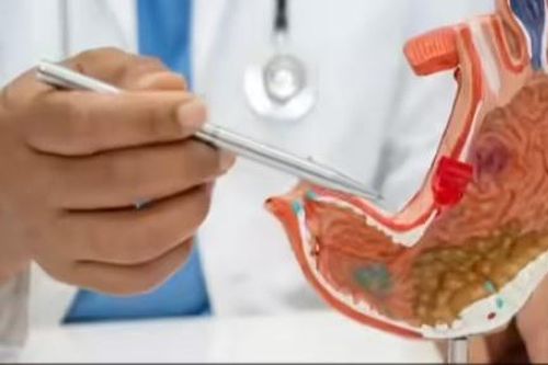 Ung thư dạ dày: 5 triệu chứng ban đầu tưởng chừng vô hại thường bị bỏ qua