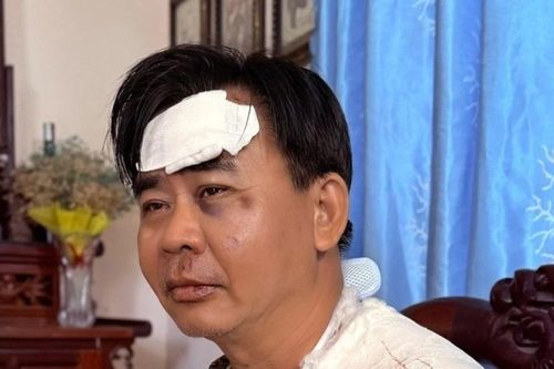 Tình trạng nghệ sĩ Chánh Thuận sau tai nạn xe