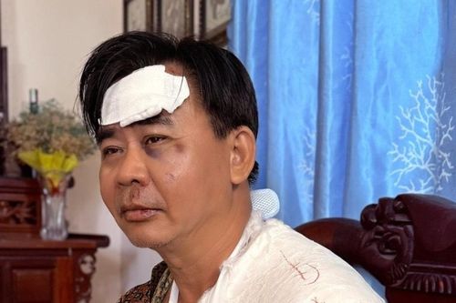 Sức khỏe nghệ sĩ Chánh Thuận sau tai nạn: Gãy xương vai