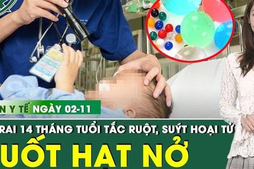 Bản tin Y tế 2/11: Nôn liên tục, bụng phình to, bé trai được phát hiện tắc ruột do 4 hạt nở