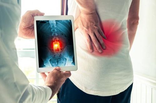 'Vi trùng' ung thư được tìm thấy từ bao giờ?