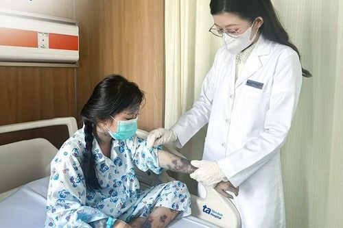 Bệnh nhi bùng phát vảy nến vì điều trị sai cách