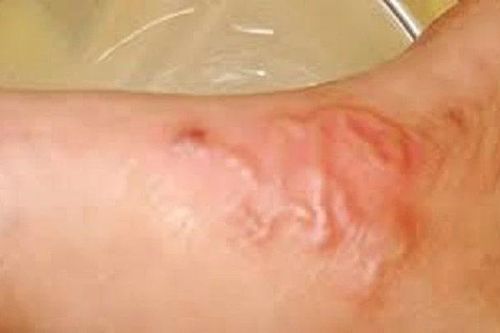 Bệnh giun sán gia tăng tại Khánh Hòa, nguy cơ từ nuôi chó mèo