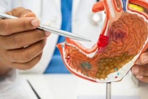 5 triệu chứng cảnh báo ung thư dạ dày dễ bị bỏ qua