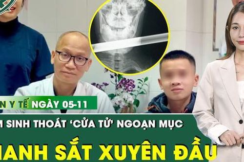 Bản tin Y tế 5/11: Nam sinh thoát 'cửa tử' ngoạn mục sau tai nạn bị thanh sắt đâm xuyên đầu