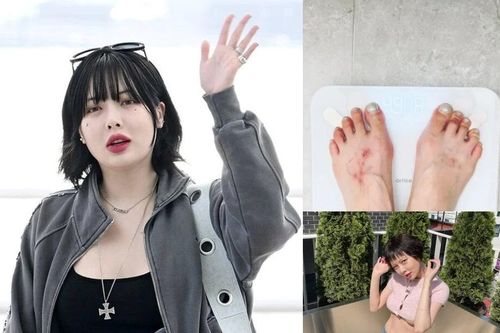 'Mỹ nhân gợi cảm nhất showbiz' HyunA để lộ dấu hiệu đáng lo