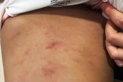 Tạm đình chỉ nhóm trẻ tư thục có trẻ bị bạo hành ở Cà Mau