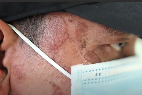 Người dân TP.HCM khổ sở vì kiến ba khoang