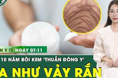 Bản tin Y tế 7/11: Người phụ nữ da nứt đỏ tím như vảy rắn sau 10 năm bôi kem 'thuần Đông y'