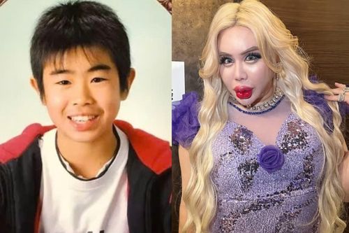 Dao kéo hơn 200 lần để thành 'người đẹp nhất thế giới'