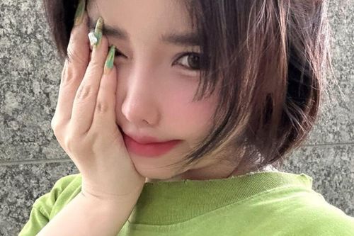Nữ ca sĩ bị biến dạng khuôn mặt có động thái lạ giữa ồn ào kiện cáo