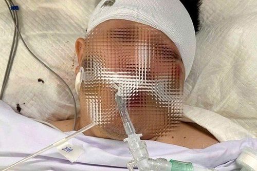 Nam thanh niên nguy kịch sau khi tông trúng chó chạy rông sang đường