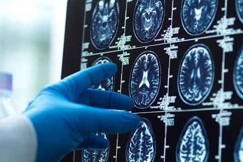 Phim chụp não người khiến nhà khoa học sửng sốt