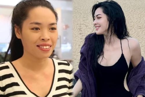 Sắc vóc cô gái 'đổi đời' nhờ dao kéo sau 10 năm